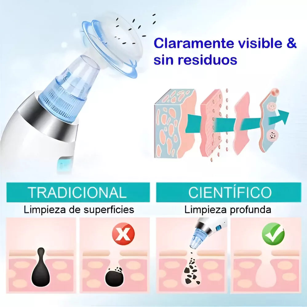 Limpiador Puntos Negros Espinilla Inalambrico Led Potente