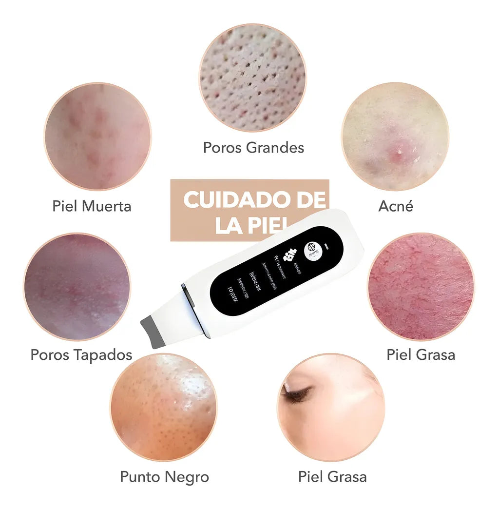 Limpiador Facial Ultrasonido Peeling Facial Puntos Negros FEDE ADELANTE 05
