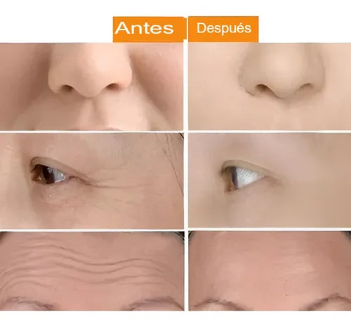 Rodillos Adelgazantes Para La Cara Masajeador Facial 2 En 1